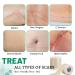 3 Rolls Silicone Scar Sheets - Reusable Scar Removal Strips for Prevention & Repair | Light Brown Silicone Scar Tape - Buy Online on GoSupps.com
