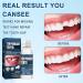 Tooth Filling Repair Kit Temporary Tooth Filling Repair Broken Teeth Broken Teeth Denture Kit Handmade at Home DIY Denture Filling with 4 Types of Dental Mirror Tools Convenient and Fast - Buy Online on GoSupps.com