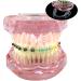 HDGRNCC Dental Orthodontic Brackets Model - Metal Ceramic Self-Ceramic Bracket for Training | International Shipping - Buy Online on GoSupps.com