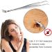 iJiZuo 2-in-1 Professional Tick Tweezers and Tick Hooks Reliable Against Ticks of Any Size Tick Remover for Humans Dogs Cats (with Leather Bag) - Buy Online on GoSupps.com