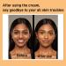 Turmeric Kojic Acid Face Cream- Natural Turmeric Skin Brightening Lotion for Face & Body Anti-Aging Cream Turmeric Face Moisturizer for Dark Spots Dry Skin Hydrating Firming Even Tone - Buy Online on GoSupps.com