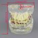 Shop Dental Malocclusion Orthodontic Treatment Model - Metal Brackets & Colorful Ties | M3005 - International Shipping Available - Buy Online on GoSupps.com