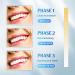 Teeth Whitening LED Light Teeth Whitening Kit TOWODE Tooth Whitening with Timing Function 32 LED Red and Blue Light Teeth Whitening Lamp with Charging Case Whiten Teeth Faster 1 ml (Pack of 1) - Buy Online on GoSupps.com