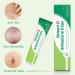 Anti-Itch Skin Repair Ointment | Bites Itch Relief | Sensitive Skin | 5g - Buy Online on GoSupps.com