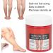 Saluaqui 80g Varicose Veins Relief Cream - Professional Treatment for Calf Muscle & Leg Phlebitis - Buy Online on GoSupps.com