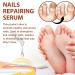 7 Days Nail Growth Serum Set - Repair & Strengthening Cuticle Oil for Damaged Nails - Buy Online on GoSupps.com