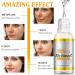 Shefave Vitamin C Serum for Face - Dark Spot Remover - Face Serum with 30x Vitamin C and Hyaluronic Acid - Anti-Dark Spot Serum - Fading Dark Spots for Tired Pale Skin - Buy Online on GoSupps.com
