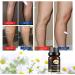 Marronie Oil for Varicose Veins Marronie Chamomile Essential Oil for Varicose Veins 1/3/5 Pack Marronie Oil Varicose Veins (3pcs) - Buy Online on GoSupps.com