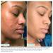 Urban Skin Rx Clear & Even Tone Glycolic Pads - Exfoliating Formula with Salicylic Acid for Blemish-Free, Balanced Skin | 30 Count - Buy Online on GoSupps.com