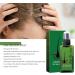 Serum Cheveux S rum de Croissance des Cheveux Avec Biotine Huile Pousse Cheveux pour Hommes et Femmes Traitement de Perte de Cheveux Hair Serum Pour Acc l rer la Croissance des Cheveux 120ml - Buy Online on GoSupps.com