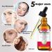 Rosehip Oil 60ML Organic Rosehip Seed Oil Anti-Aging Natural Cold Pressed Unrefined For Face Hair Nail Scar All Skin & Hair Typess - Buy Online on GoSupps.com