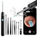 Ear Wax Removal, Ear Cleaner with Camera, Ear Wax Removal Tool with 1080P, Ear Camera Otoscope with Light, Ear Wax Removal kit for iPhone, iPad, Android Phones Black