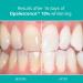 Opalescence 10% Teeth Whitening Gel Syringes - Mint Flavor - 4 Pack - Buy Online on GoSupps.com
