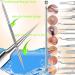 Pimple Popper Tool Kit - 16 PCS Blackhead Remover & Acne Extractor Set for Blemish and Ingrown Hair Removal - Buy Online on GoSupps.com