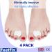 FeetFix Bunion Corrector Toe Separators Minimally Invasive Gel Hallux Valgus Big Toe Straightener Protector Splint Immediate Foot Pain Relief 4 Pack Wear With Shoes Spacer Medical Grade - Buy Online on GoSupps.com