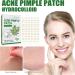 Nmbol Acne Patch Colorful 3 - Buy Online on GoSupps.com