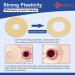 Carbou Ostomy Barrier Rings 2 (50mm) 3.5mm Thickness - Pack of 10 | Compatible with All Bag Types - Buy Online on GoSupps.com