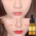 Essential Nose Oil - Thin Smaller Nose Care Massage Oil | 10 ml | International Shipping - Buy Online on GoSupps.com