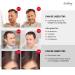 Godefroy Spot Color Kit - Medium Brown, Covers Gray Hairs, 4-Applications - Buy Online on GoSupps.com