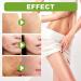 Essence r paratrice de cicatrices avanc e naturelle s rum r parateur de cicatrices de qualit m dicale r pare et lisse la peau pour tous types de cicatrices 1Pcs - Buy Online on GoSupps.com