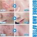 Gla-Mory Micros-Infusions System for Lips Gla-Mory Micro-Infusions System with Serum Hyaluronic Acid Serum Gla-Mory Facial System Hydrating Serum for All Skin Face Serum for Women (Serum+Roller) - Buy Online on GoSupps.com