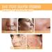 Glycolic Acid 7% Toning Resurfacing Solution - Glycolic Sour 7% Toner - Hydrating Toning Solution - Skincare Hyaluronic Acid Serum - for Blemishes and Acne Prevents Skin Aging Strengthen Your Skin - Buy Online on GoSupps.com