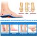 Orthopedic Heel Spur Insoles for Flat Feet - Size S (39-41) - Comfort & Support for Shoes - Buy Online on GoSupps.com