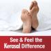Kerasal Intensive Foot Repair Ointment & Peel Set for Cracked Heels and Dry Feet - 1oz Ointment & 2 Pairs Foot Peel - Buy Online on GoSupps.com