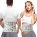 Back Brace for Men and Women Back Support Belt for Lower Back Pain Relief Scoliosis Sciatica Herniated Disc Heavy lifting Lightweight Breathable Lumbar Support with Dual Adjustable Straps (Medium)