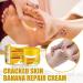  smashing smashing Chapped Feet Repair Cream | Banana Foot Repair Skin Healing Moisturizing 30g Chapped Heel Moisturizer Foot Repair for Removing Dead Skin - Buy Online on GoSupps.com