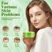 Aloe Vera Eye Pads 60 PCS - Anti-Aging, Soothing, Hydrating & Moisturizing Under Eye Patches - Buy Online on GoSupps.com