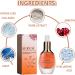 Hyaluronic Acid Serum for Face - Face Serum for Women - Cheery Dark Spot Remover for Face Serum - Anti-Aging Skin Firming - Moisturizing and Whitening - Mild Formula 30ml - Buy Online on GoSupps.com