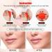 Buy Soft Silicone Fish Shape Lip Pump | Lip Plumper & Enhancer for Fuller Thicker Lips - Fast Results for Women (RED - Buy Online on GoSupps.com