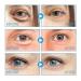 Caffeine Eye Cream for Dark Circles & Puffiness | Anti-Aging Treatment for Fine Lines & Bags (2PCs) - Shop Now! - Buy Online on GoSupps.com
