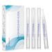 Kingheroes Teeth Whitening Pen(4 Pcs), 30+ Uses, Effective, Painless, No Sensitivity, Travel-Friendly, Easy to Use, Beautiful White Smile, Natural Mint Flavor