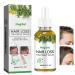 MagiForeign Hair growth serum rosemary oil accelerates hair growth with rosemary for hair growth oil massage the scalp to care for the hair prevents hair loss for men and women 60 ml