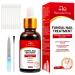 Recuren Plus Extra Strength Toenail Fungus Treatment Nail Repair for Damaged Cracked Discolored Nails Tea Tree Formula for Fast Fungus Removal & Growth Strengthener - 1.01 Fl Oz