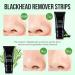 Black Head Remover | Peel Off Charcoal Mask for Deep Cleansing Pores | Acne Treatment for Men & Women - Buy Online on GoSupps.com