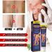 Varicose Veins Cream Spider Vein Cream Varicose Veins Treatment for Legs Spider Veins Treatment Cream Vein Cream for Legs Spider Veins Repair Cream Varicose Veins Ointment Aching Legs Relief - Buy Online on GoSupps.com