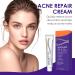 Halercay 20g acne cream reduces the volume of pimples effectively improves pimples on the face removes acne for pimpleprone skin makes the skin look smooth - Buy Online on GoSupps.com