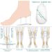 6 Pairs Heel Silicone Insoles for Foot Alignment - Medial & Lateral Adhesive Shoe Inserts for Bow Legs & O/X Type Leg - Buy Online on GoSupps.com