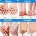 42% Urea Foot Cream Urea Cream 42 Percent for Feet Cracked Heel Repair Cream Foot Cream for Cracked Heels and Dry Skin Hard Skin Remover Foot Cream Urea Cream Soften Deep Moisturizing Foot Moisturiser - Buy Online on GoSupps.com