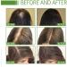 Natural Hair Growth Oil Hair Regrowth Treatment Hair Growth Serum Hair Growth Oil Hair Regrowth Extract Oil for Women Men Natural Thinning Hair & Nourish Hair Follicles - Buy Online on GoSupps.com