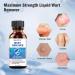 QSOOWIS Wart Remover Skin Tag Remover for Warts Plantar Wart - 1 Fl Oz - Buy Online on GoSupps.com