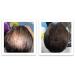 Caboki Hair Building Fiber 16G Dark Brown - Instantly Thicker Hair Solution - Buy Online on GoSupps.com