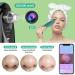 Blackhead Remover Pore Vacuum with Camera - Rechargeable Blackhead Suction Tool for Face and Nose - Skin Acne Pimple Cleaner for Men and Women - Buy Online on GoSupps.com