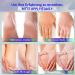 Cr me l'ur e avec 2 % d'acide salicylique pour les pieds - Pour talons secs et craquel s - Hydrate et limine les cors les callosit s les peaux mortes et adoucit les ongles des pieds - 140 ml - Buy Online on GoSupps.com