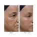 Dr. Denese Wrinkle Lost Line Reducer - 3 Minute Age Eraser with Silk Protein Technology | Buy Internationally - Buy Online on GoSupps.com