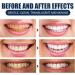 Remineralizing Tooth Powder for Healthy Teeth & Gums | Natural Teeth Whitening Powder - International Shipping - Buy Online on GoSupps.com