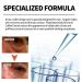 Mens Expert Energetic Eye Roller Mens Eye Cream Roller Lifting Eye Gel for Men Men's Eye Roller Energetic Eye Roller Anti-Aging Under Eye Serum Roller Energetic Roller Expert Circles - Buy Online on GoSupps.com